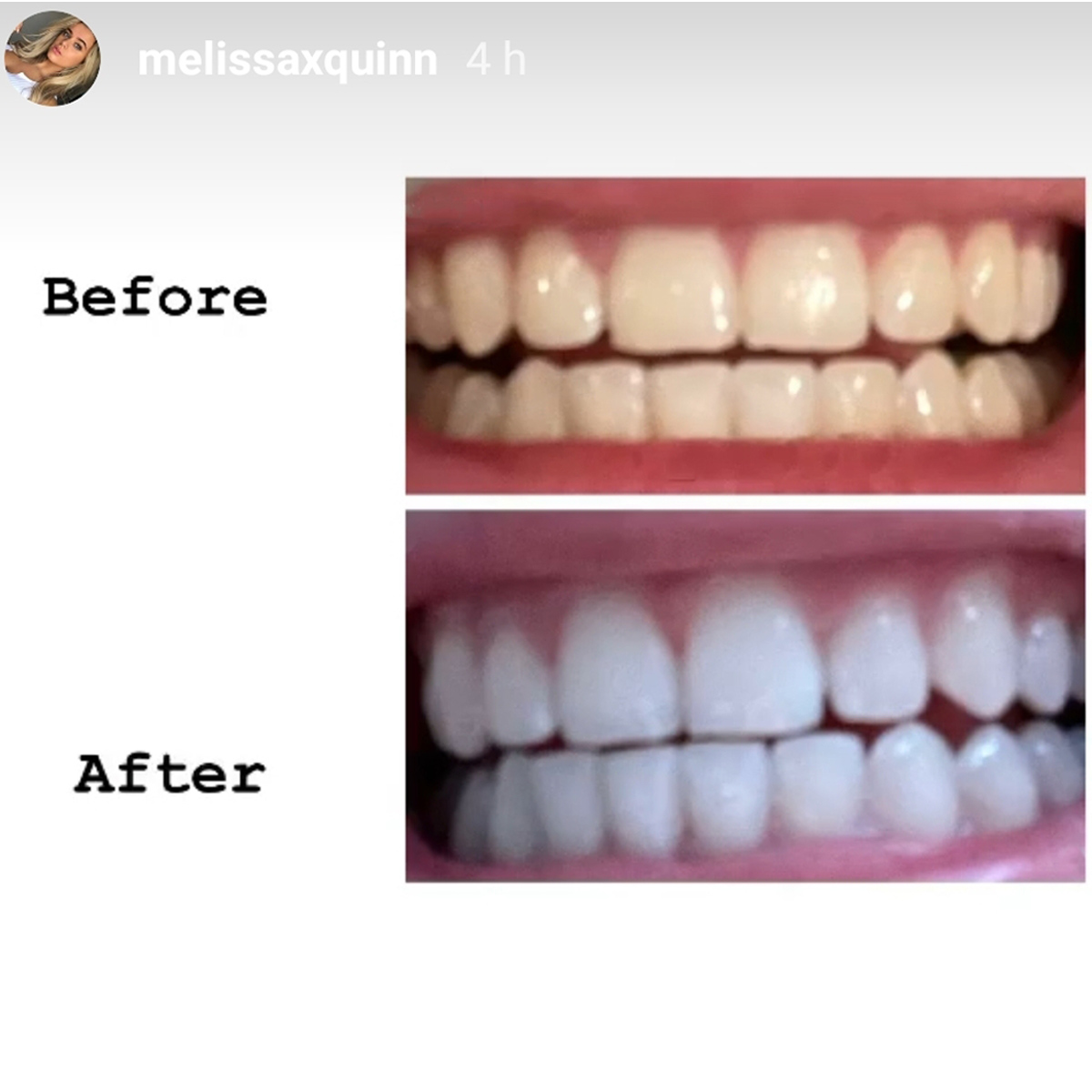 Before & After Melissaquinn Website